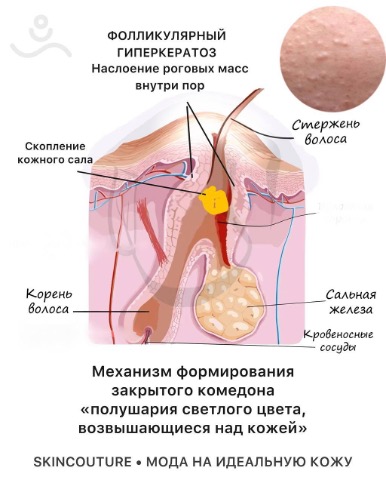Изображение выглядит как текст, снимок экранаКонтент, сгенерированный ИИ, может содержать ошибки.
